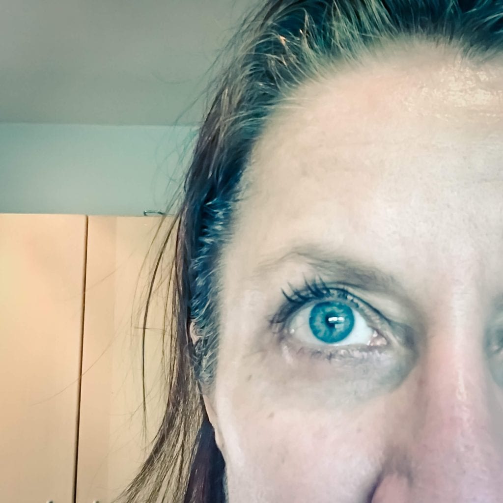 eye with dark circles