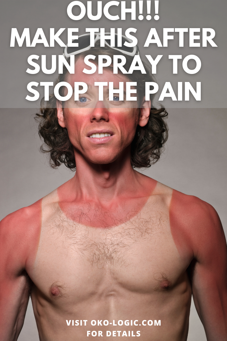 How to Get Rid of Sunburn Itching with an Easy and 100% Natural DIY Spray