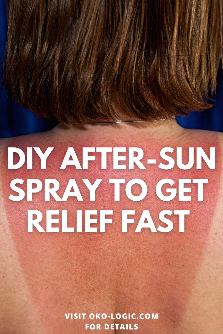 How to Get Rid of Sunburn Itching with an Easy and 100% Natural DIY Spray