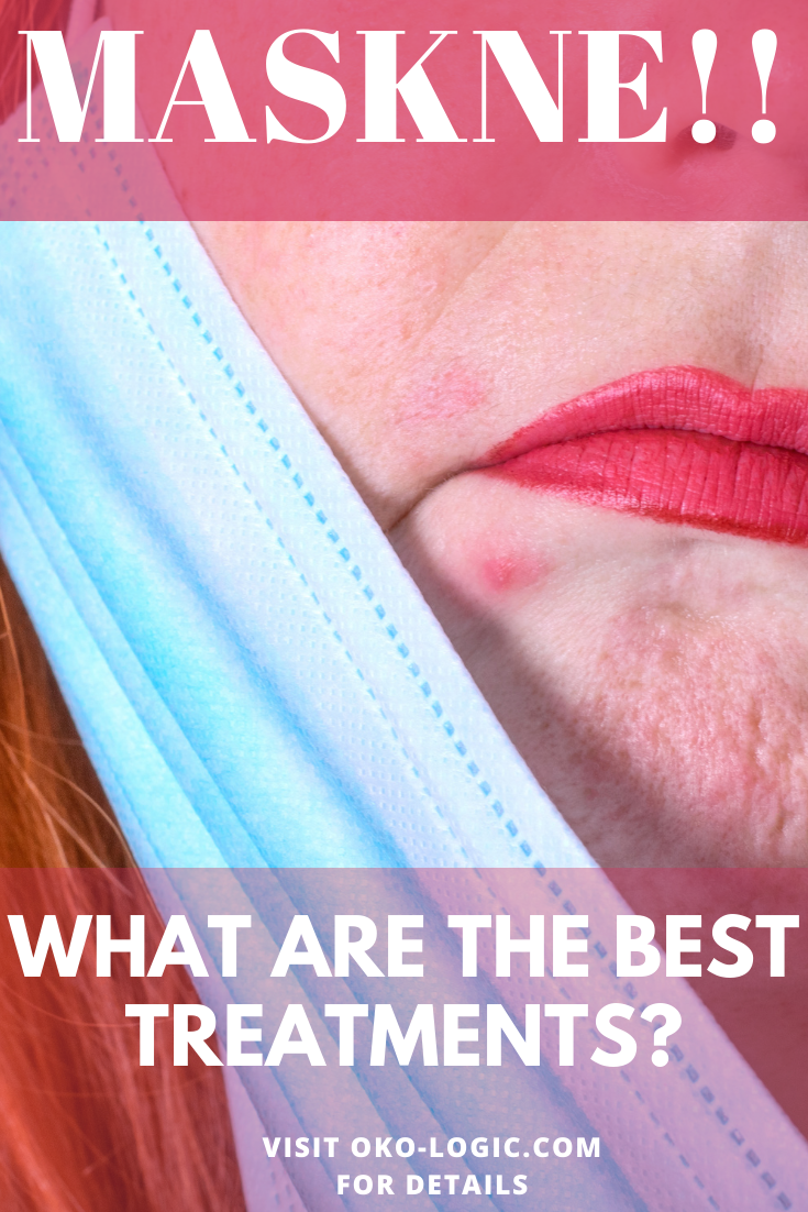 11 Proven Mascne Treatment Options and Ways to Prevent It In the First Place