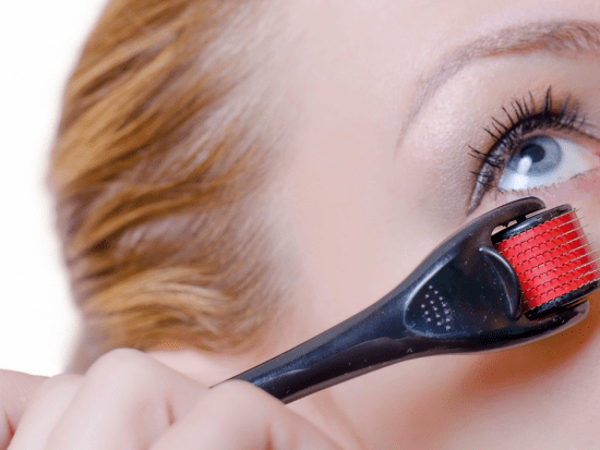 microneedling under the eye