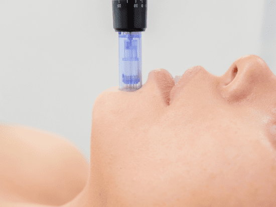 best at home microneedling pen